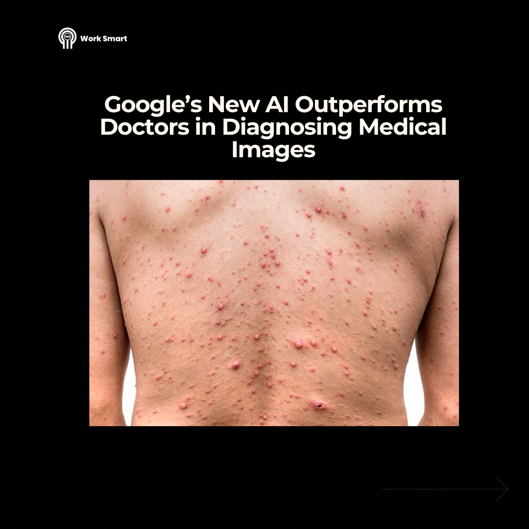 Google’s Medical Chatbot Outperforms Doctors in Diagnosing Health Images